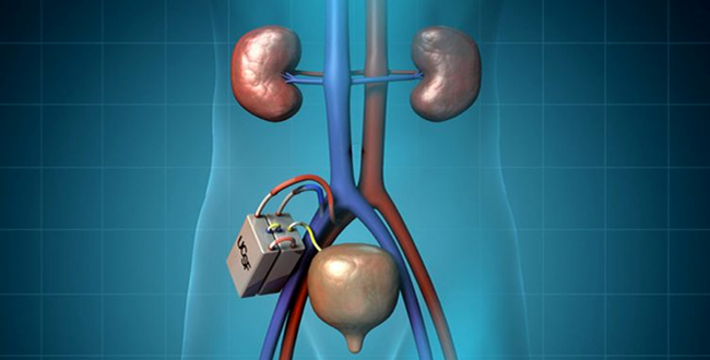 MED DEVICE ON-LINE NEWS , 2015/11/3 より転載